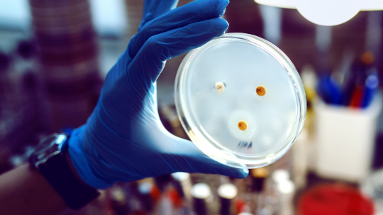 Una persona en un laboratorio con guantes azules sostiene una placa de Petri.