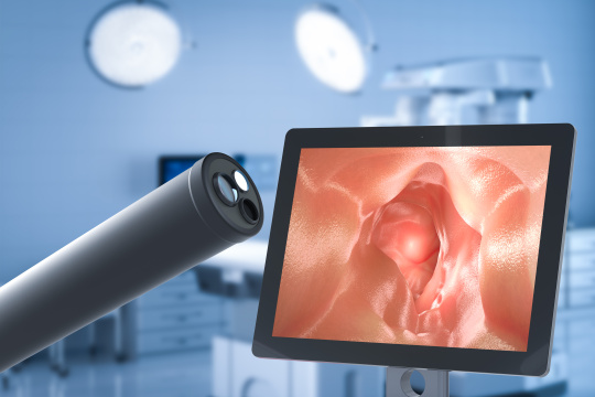 Endoscopio con sensores junto a una pantalla que muestra el interior del cuerpo