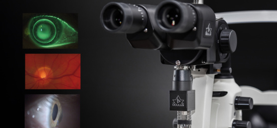 La lámpara de hendidura con cámara IDS capta los segmentos anterior, medio y posterior del ojo.