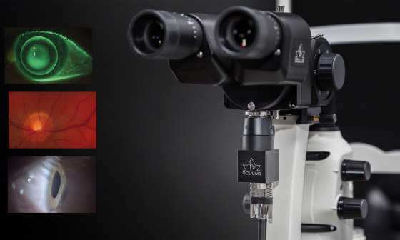 La lámpara de hendidura con cámara IDS capta los segmentos anterior, medio y posterior del ojo.